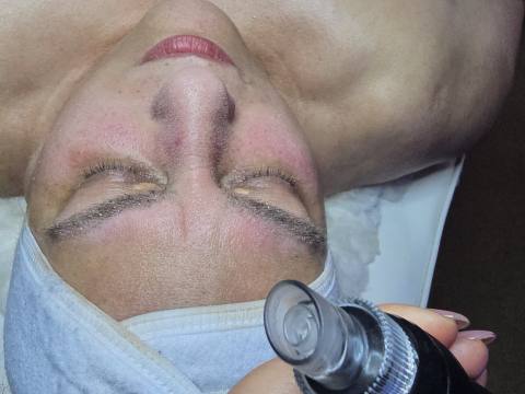 Turqueza Med Spa, foto 6